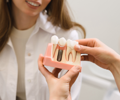 Dental Implants Explained: Everything You Need to Know Before Replacing a Missing Tooth